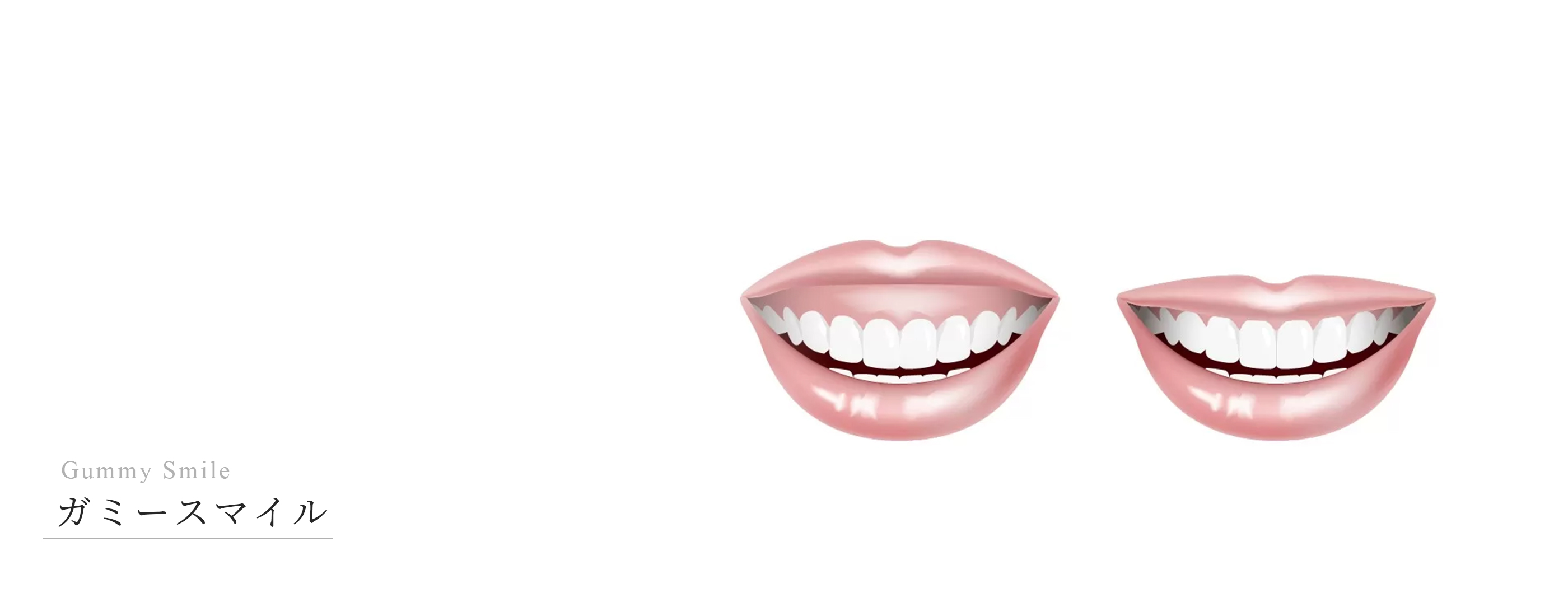 キービジュアル